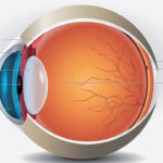 Cirurgia Retina