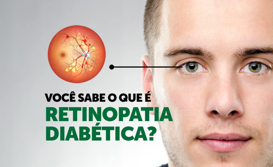 retinopatia-diabetica-inada-oftalmologia-3