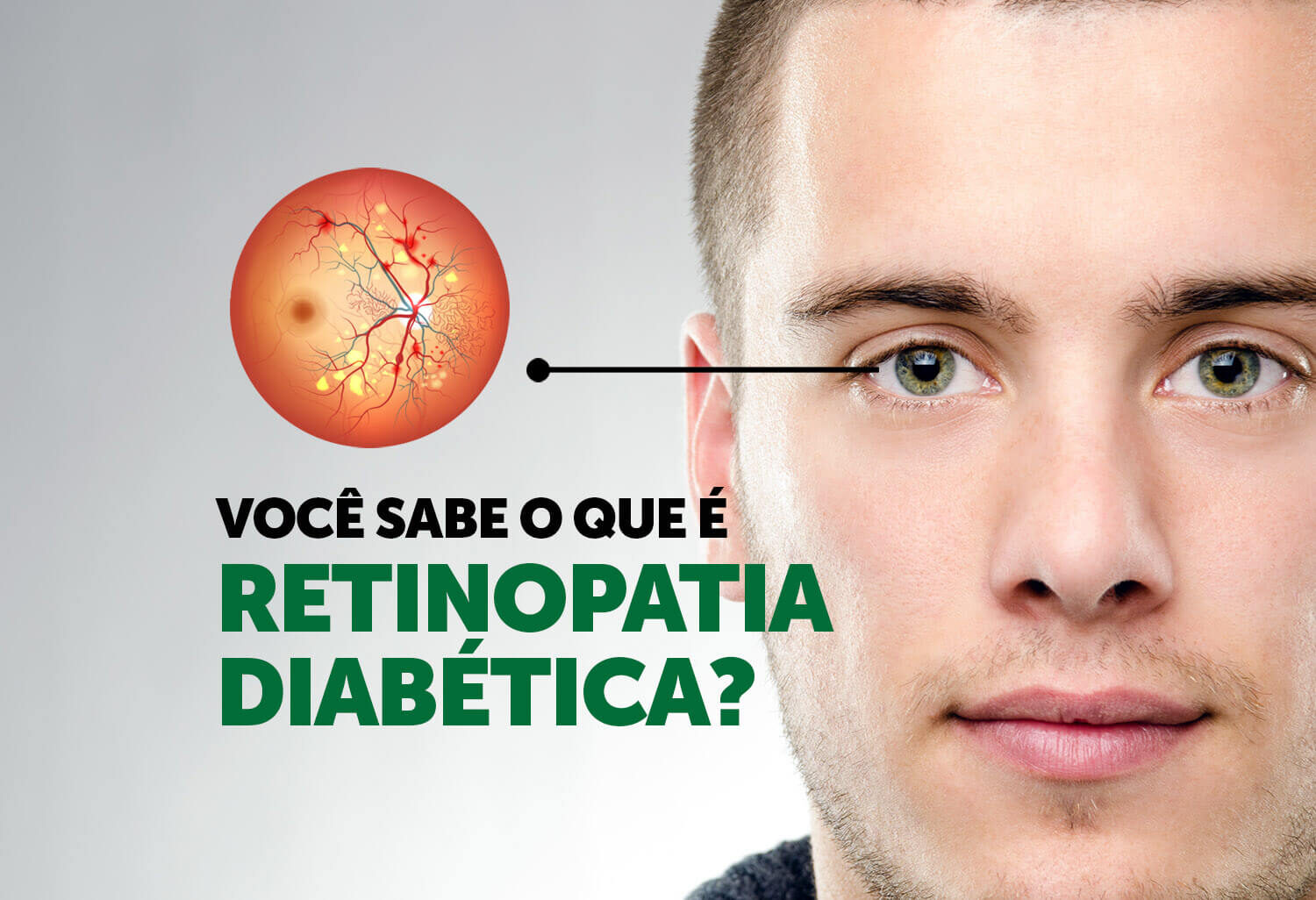 retinopatia-diabetica-inada-oftalmologia-3