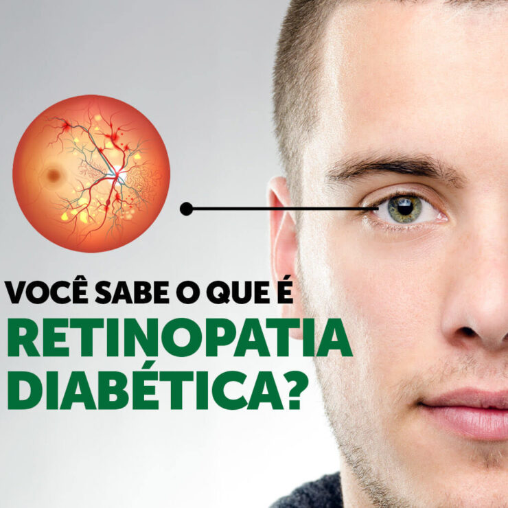 retinopatia-diabetica-inada-oftalmologia-3